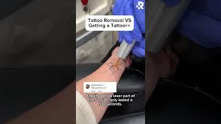 How painful is tattoo removal at Removery?