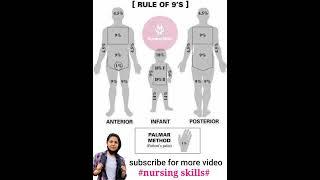 Rule of nine | palmar method |