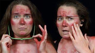 Sunburn Makeup Tutorial I Beginner Friendly SFX Makeup Tutorial