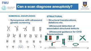 Aneuploidy Screening Dr C Chirume