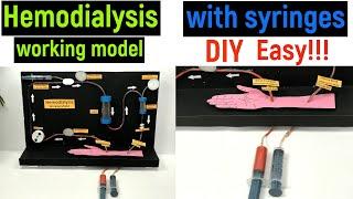 hemodialysis working model - hemodialysis working model with syringes - diyas funplay - diy project