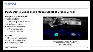 PSEG Tool for PET Image Segmentation (Overview)