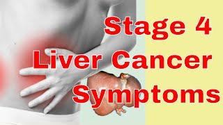 Stage 4 Liver Cancer Symptoms