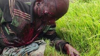KAMONYI: Yakubiswe ferabeto mu mutwe ava amaraso ijoro ryose habuze imbangukiragutabara imujyana kwa