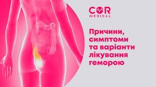 Запитання проктологу. Частина перша: причини, симптоми та варіанти лікування геморою