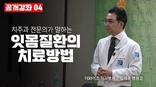 치아가 흔들리면 임플란트 하나요?_임세웅 병원장