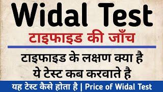 Widal Test क्या होता है? | Widal test in hindi