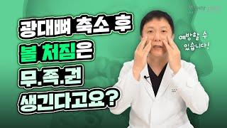 [안면윤곽] "광대뼈축소술을 하면 무조건 얼굴 살이 처질까??" 윤곽수술 후 볼처짐의 원인과 예방법, 근본적인 해결법 바로알기!