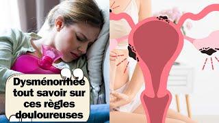 Dysménorrhée : tout savoir sur ces règles douloureuses