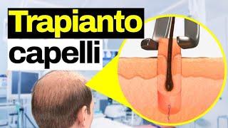 Si sradicano i bulbi con una sorta di levatorsoli - il TRAPIANTO DEI CAPELLI