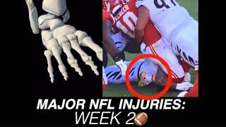 Data Analysis: NFL Week 2 Injuries | FASTEST Minute