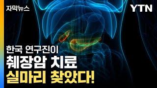 [자막뉴스] 국내 연구진이 실마리 찾았다! '최악의 암' 췌장암 정복 기대 / YTN