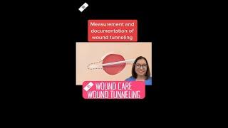 Wound tunneling: Wound Care SHORT | @LevelUpRN