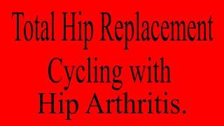 Cycling with Hip Arthritis.