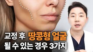 교정 부작용? 볼패임과 땅콩형 얼굴이 될 수 있는 경우 3가지