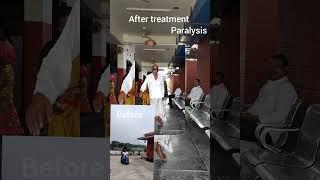 Paralysis #14days  #panchakarma treatments