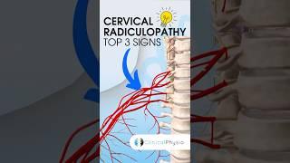 Cervical Radiculopathy Top 3 Signs #physiotherapy #physicaltherapy