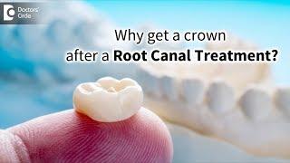 How necessary is it to cap or crown teeth after the root canal process?- Dr. Vahini Reddy