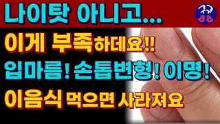 입이 마르고 침이 끈적거리고 혀가 아픈 입마름 ! 귀에서 심장 소리가 들리고 삐 소리가 나는 이명...손톱에 줄이 생기고 갈라지고...나이탓이 아니고 이것이 부족합니다