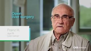 Quality Ablation - Patient Franz (English)