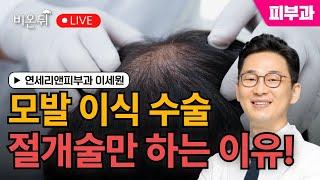 모발 이식 수술: 내가 절개술만 하는 이유! / 연세리앤피부과 이세원