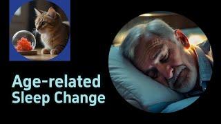 Age-related Sleep Change - Insomnia | USMLE UWorld Question, USMLE Step 1, Nervous System