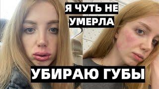 Я ЧУТЬ НЕ УМЕРЛА У КОСМЕТОЛОГА!!! УБИРАЮ ГУБЫ ПОЛНОСТЬЮ