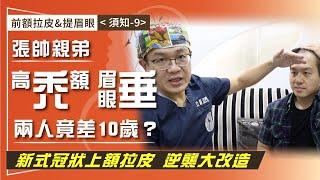 前額拉皮&提眉眼（須知-9）前額禿、眉眼下垂顯老10歲！ 張帥親弟「新式冠狀上額拉皮」逆襲改造計畫大公開