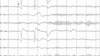 EEG Tutorial