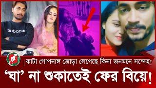 জুনিয়র সাকিবের বিয়ে নিয়ে যত বিতর্ক, শুকায়নি গো-পনাঙ্গের ঘা | Junior Sakib Marriage |SomoyerKolom