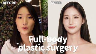 [SUB] Thai Influencer Jinny's Plastic Surgery journey in Korea