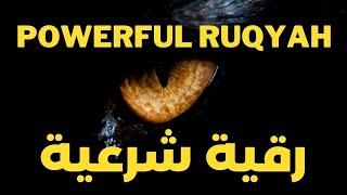 Powerful Ruqyah To Open And Remove Knots Of Magic || Marwan Al Dostaki رقية شرعية