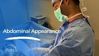 #AskDrZ | Abdominal Appearance