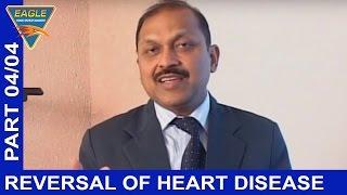 Reversal Of Heart Disease || Part 04/04 || Eagle Health