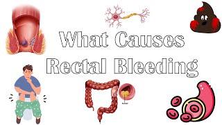 What Causes Per Rectal Bleeding |Major Causes Of Blood In Stools |Rectal Bleeding Causes