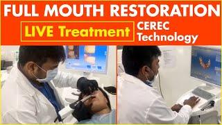 Full Mouth Restoration - LIVE Treatment | CEREC Technology | Dental Care | Eledent Dental Hospitals