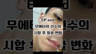 공기업 퇴사하고 태국 무에타이 도전 EP. end 무에타이 선수의 시합 후 얼굴 변화