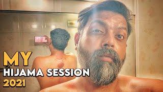 My Hijama Session | Wet Cupping  | Who Is Mubeen | Cupping Therapy