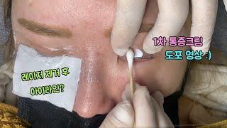 아이라인 (1차) 통증크림 도포 방법 _ 제이엠뷰티솔루션스 / JM뷰티솔루션스 / JM beauty solutions