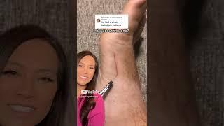 Dr. Pimple Popper Reacts to Inflamed Ingrown That Looks SATISFYING to Pull Out