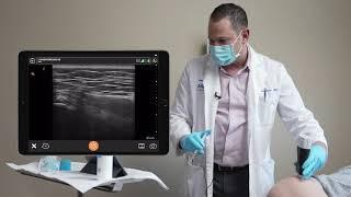 Gluteal Tendon Injections: Ultrasound Scanning Technique