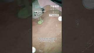 남자배렛나루제모 유스타일나인 레이저제모로! #shorts #복부관리 #털관리