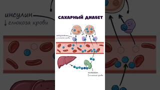 Сахарный Диабет - патогенез (инсулин, глюкагон биохимия)