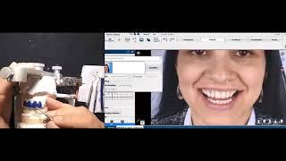 Dr. Jorge Bedoya-Restauración estética en el sector anterior_Parte II