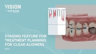 Demonstration of Automated Staging Feature for Treatment Planning for Clear Aligners