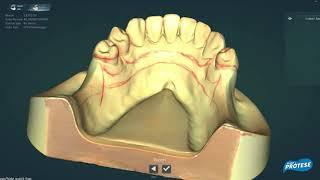 Scanner Dental Up360 Up3D - Dental Prótese