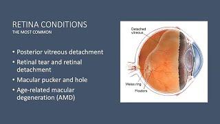 Demystifying Retinal Diseases