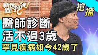 【搶播】醫師診斷活不過3歲！罕見疾病如今42歲了