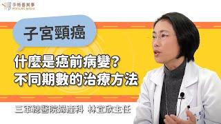 【什麼是癌前病變？子宮頸癌不同期數的治療方法有不同嗎？】林宜欣醫師／三軍總醫院婦產科主任｜手術善其事