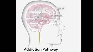 VB Addiction Pathway